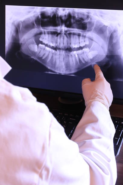 Best Emergency Denture Repair in New Iberia, LA